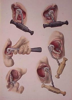 history-of-dentistry-07.jpg